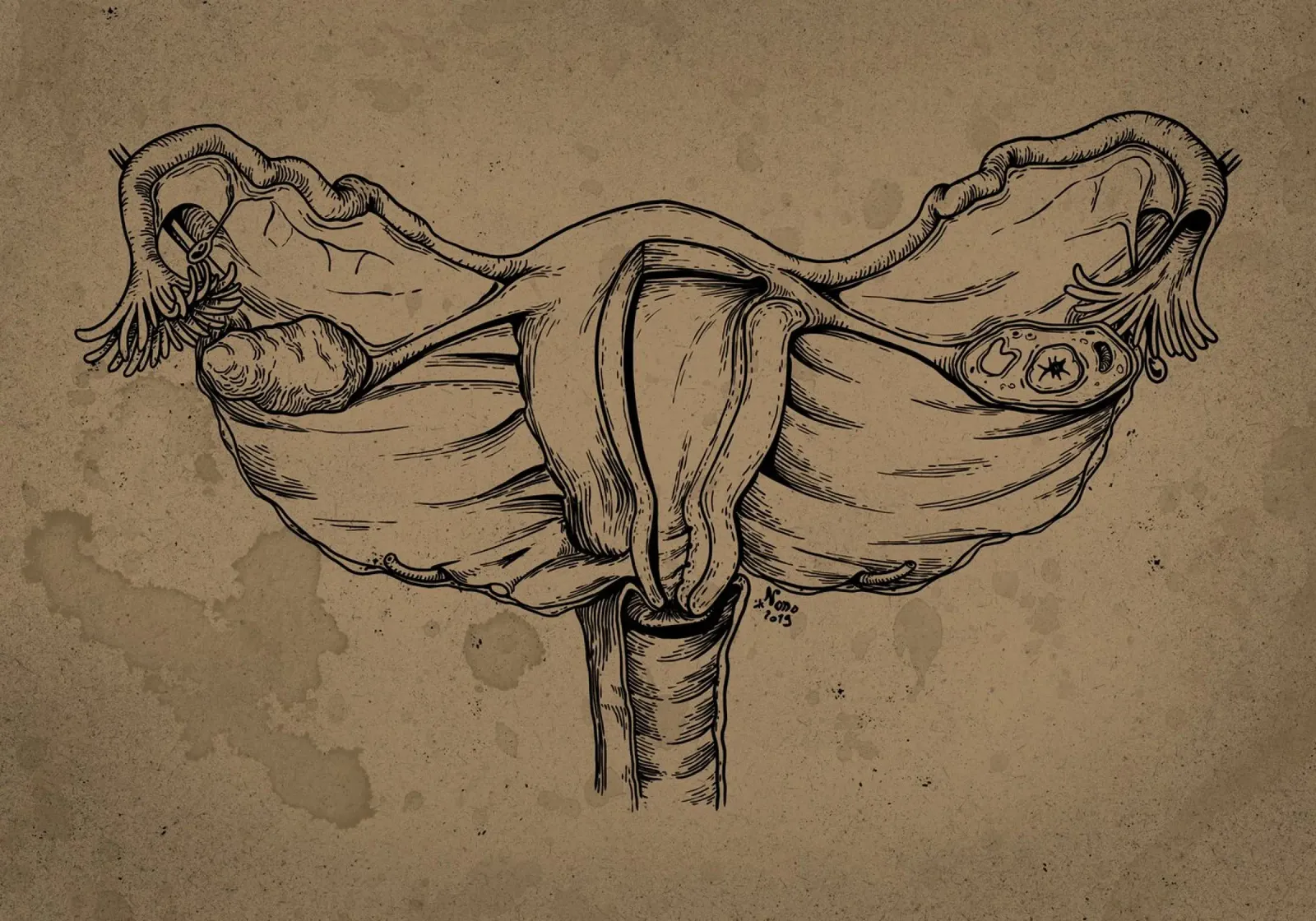 Uterus poster avec cadre en aluminium de Nora Back